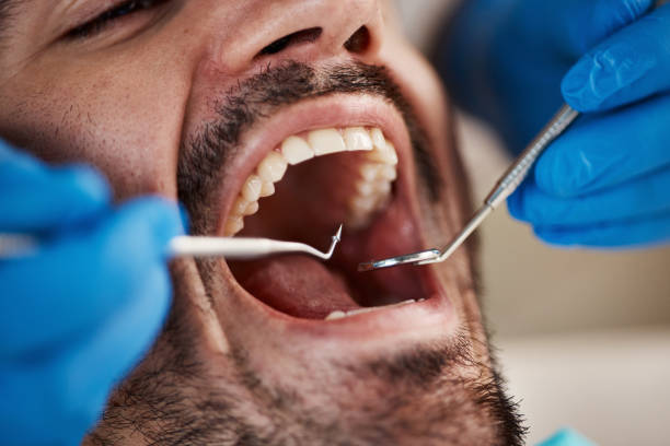 Best Dentist for Tooth Abscess  in Ancient Oaks, PA